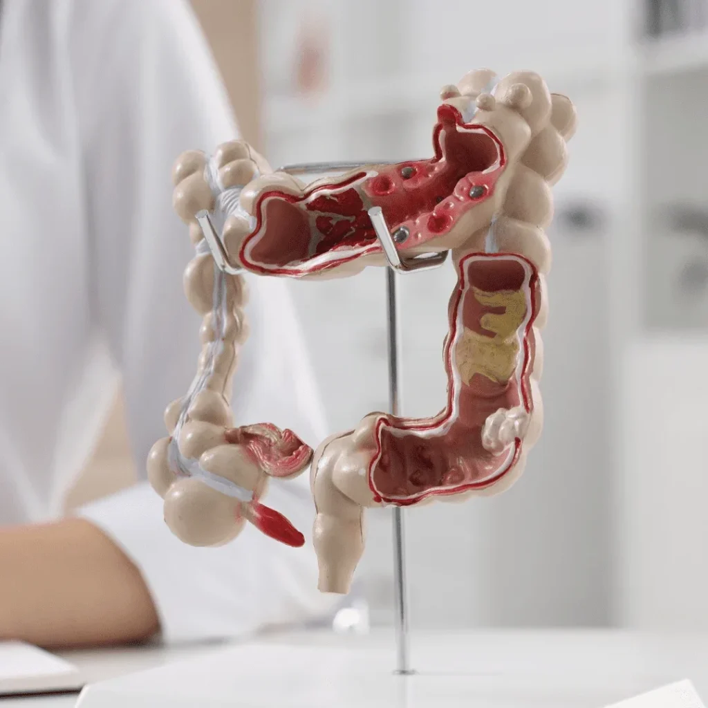 Modulação Intestinal 